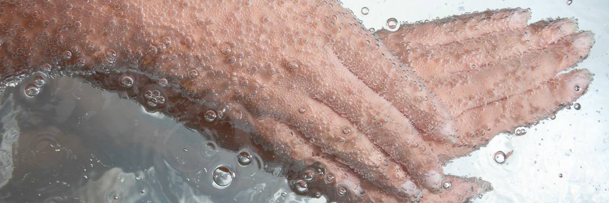 haende_kohlesaeurebad.jpg haende_kohlesaeurebad.jpg